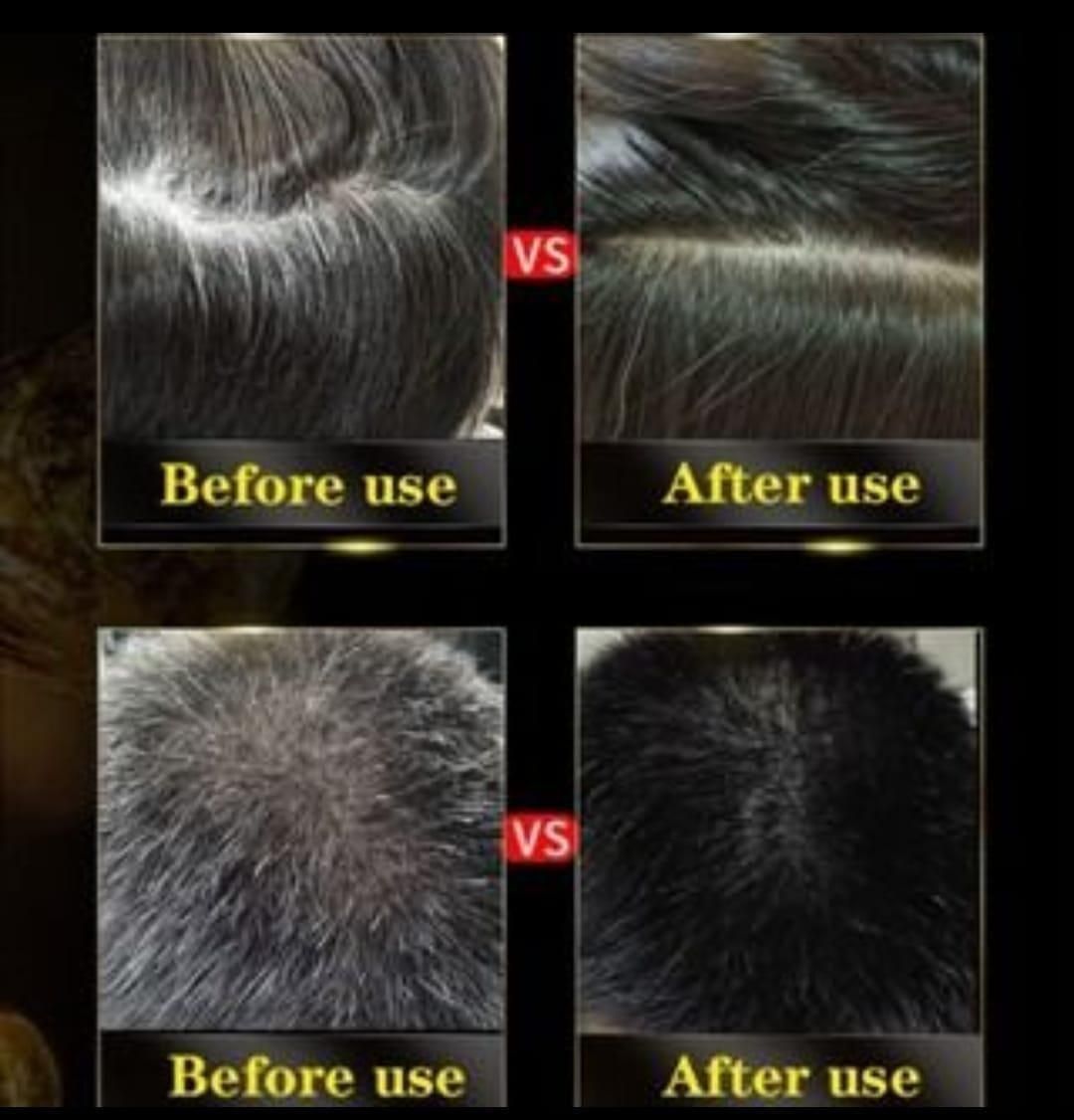 BLOSDREAM Black Hair Dye Shampoo (Buy 1 Get 1 Free)
