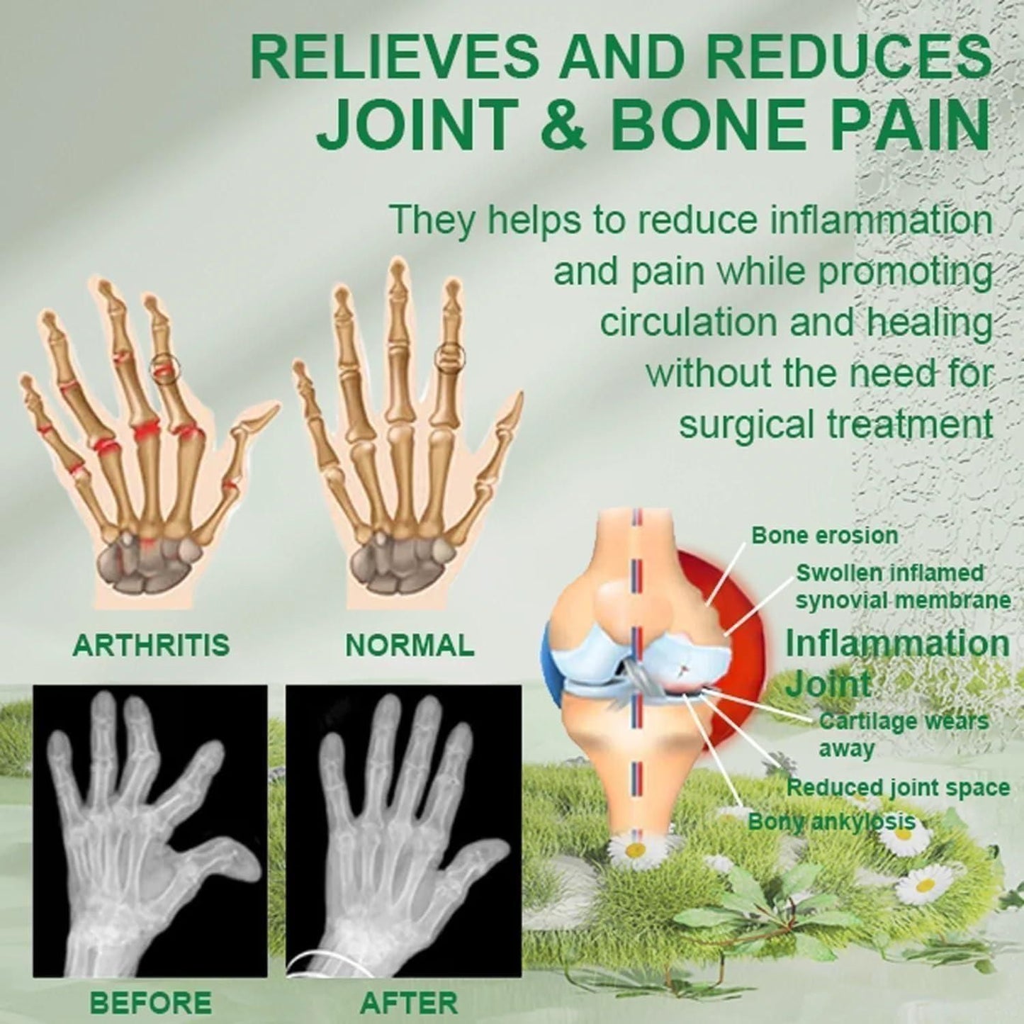 (Pack of 3) BeeTherapy™ Bee Venom Pain Relief Cream | Buy 1 Get 2 Free