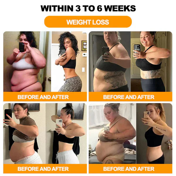 Bee Venom Detox & Slimming Body Patches – Reduce Swelling, Burn Fat, Boost Metabolism (Pack of 10)