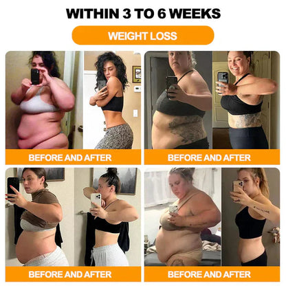 Bee Venom Detox & Slimming Body Patches – Reduce Swelling, Burn Fat, Boost Metabolism (Pack of 10)
